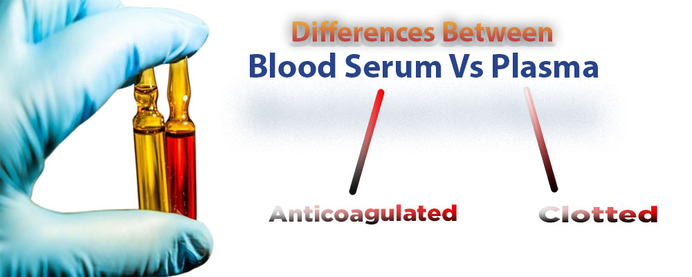 plasma vs serum
